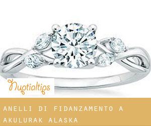 Anelli di fidanzamento a Akulurak (Alaska)