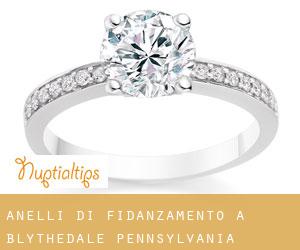 Anelli di fidanzamento a Blythedale (Pennsylvania)