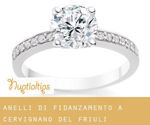 Anelli di fidanzamento a Cervignano del Friuli