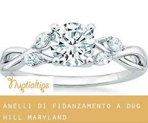 Anelli di fidanzamento a Dug Hill (Maryland)