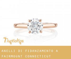 Anelli di fidanzamento a Fairmount (Connecticut)