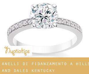 Anelli di fidanzamento a Hills and Dales (Kentucky)