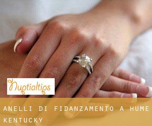 Anelli di fidanzamento a Hume (Kentucky)