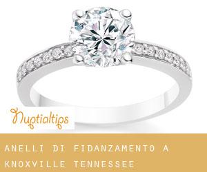 Anelli di fidanzamento a Knoxville (Tennessee) Anelli di fidanzamento a Knoxville (Tennessee)