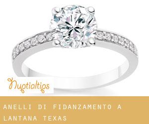 Anelli di fidanzamento a Lantana (Texas)