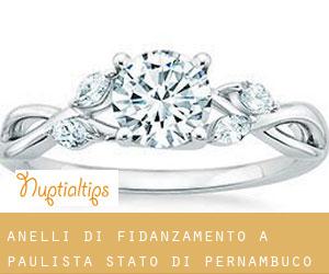 Anelli di fidanzamento a Paulista (Stato di Pernambuco) Anelli di fidanzamento a Paulista (Stato di Pernambuco)